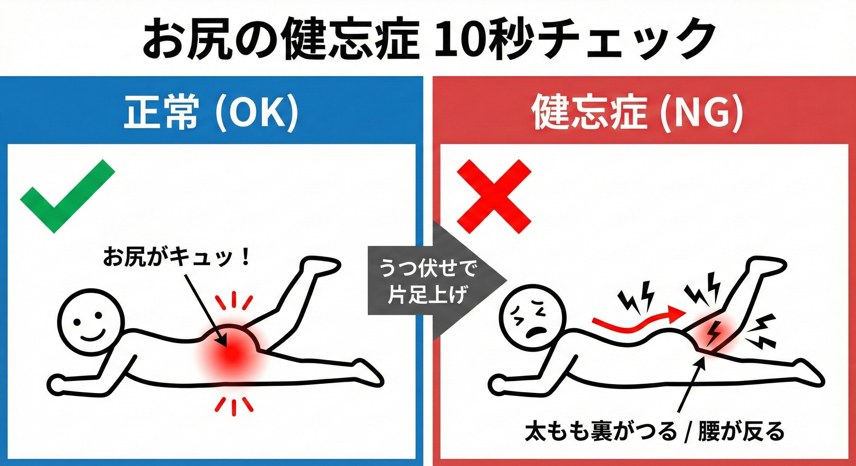 うつ伏せになって片足を上げるチェック方法のイラスト