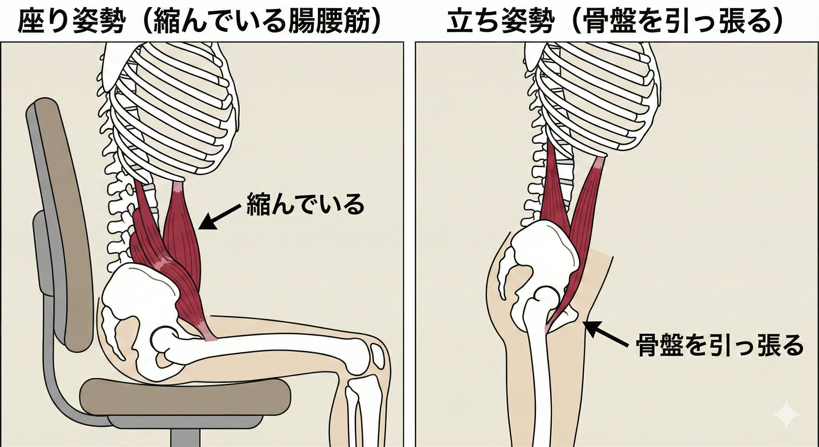 座り姿勢で腸腰筋が縮んでいる様子と、立った時に骨盤を引っ張る図解