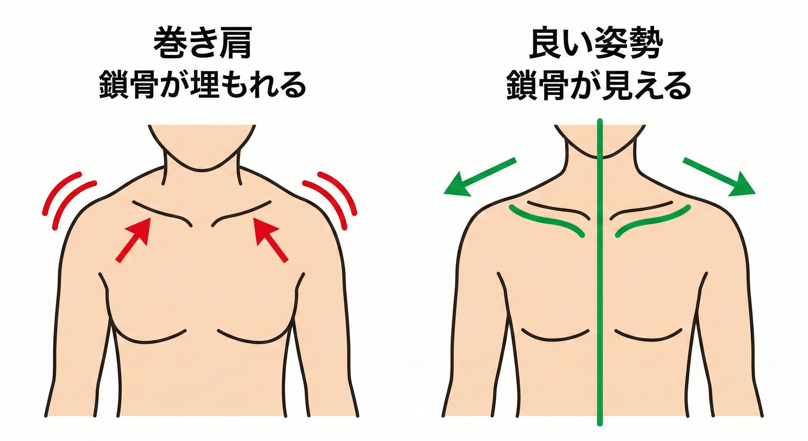 広角レンズの歪み効果と、巻き肩で鎖骨が埋もれる図解